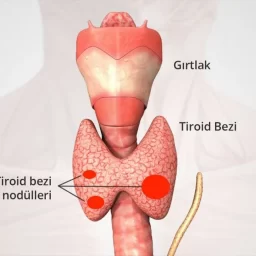 Tiroid ve Guatr Aynı Şey Mi